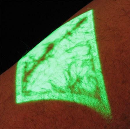 Photos: Scanning human veins