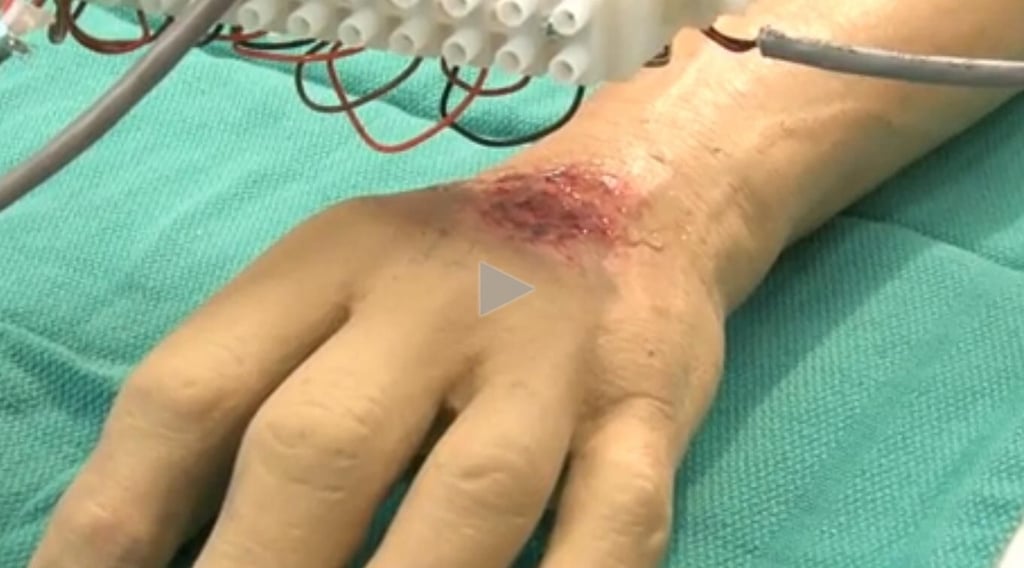 How 3D bioprinting is changing the world: Photos of 10 great projects