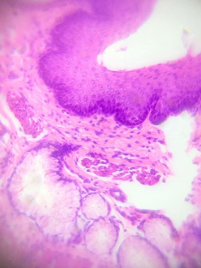 ex-esophagus-tissue.jpg