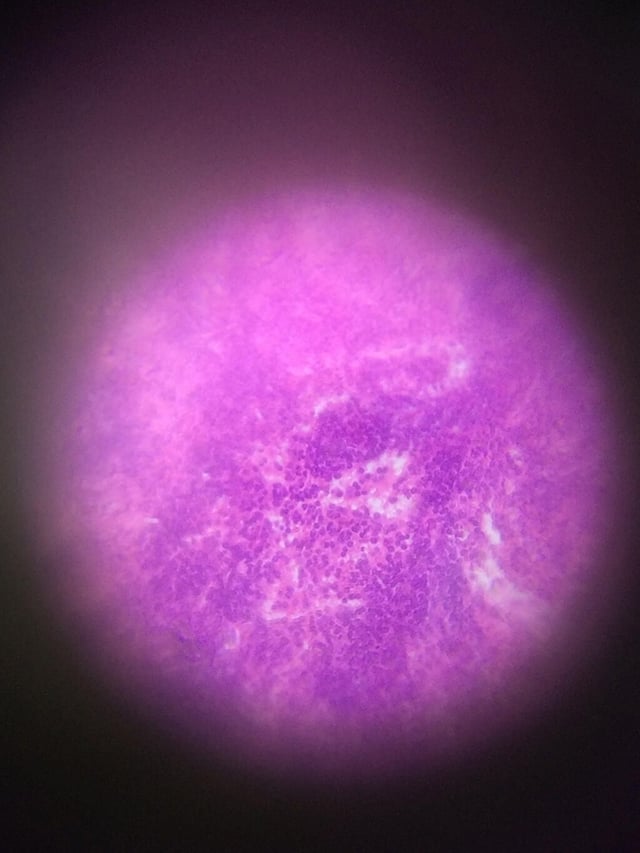 ex-spleen-tissue.jpg