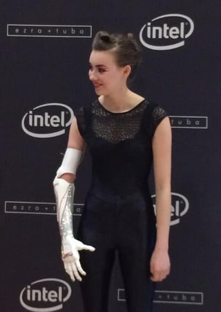 bionic-arm.jpg