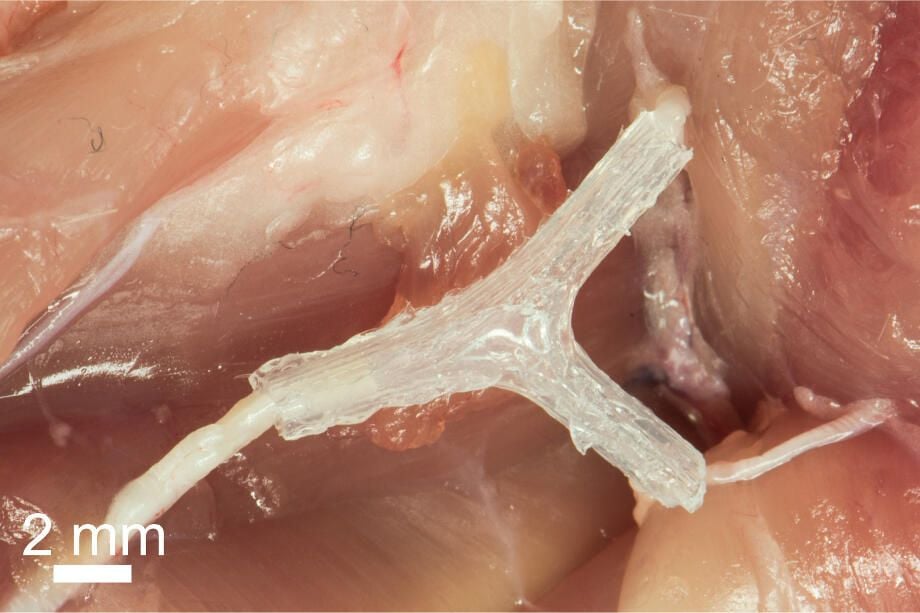 3d-printed-nerve-guide.jpg