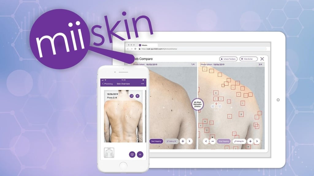New app uses AI and ML to monitor changes in skin to prevent cancer