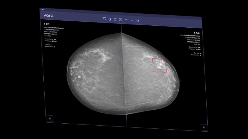 https://assets.techrepublic.com/uploads/2026/09/ai-mammogram-2.jpg?f=jpeg